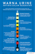 11 Warna Urine yang Bisa Tunjukan Tanda Kesehatan Anda