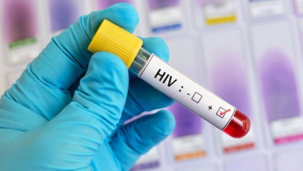Edan! Menyamar Jadi Wanita, Pria China Tiduri 1.600 Pria dan Sebarkan HIV
